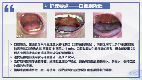 a0005 化疗后骨髓抑制患者的护理 第7页