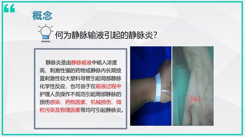 a0007 静脉炎的预防及处理_70675 第4页