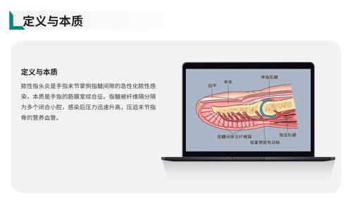 a0019 脓性指头炎护理查房带参考文献 第2页