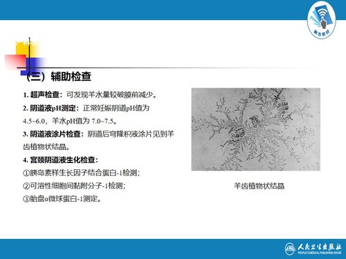 a0021 解读胎膜早破指南 第2页