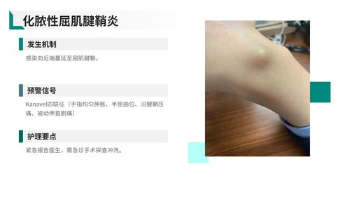 a0030 脓性指头炎护理查房带参考文献PPT37页可编辑无水印 第13页