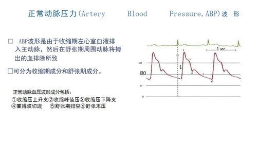 a0038 有创动脉血压监测PPT53页可编辑无水印 第8页