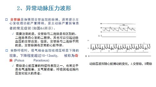 a0038 有创动脉血压监测PPT53页可编辑无水印 第10页
