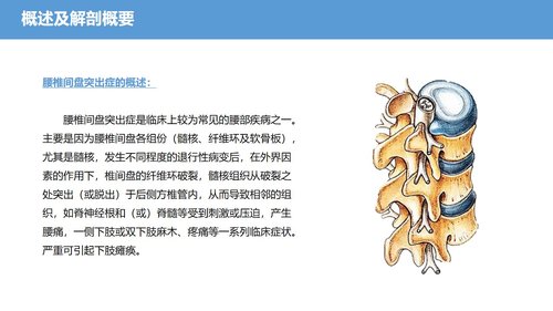 a0041 腰椎骨科护理查房腰椎间盘突出症PPTPPT38页可编辑无水印 第3页