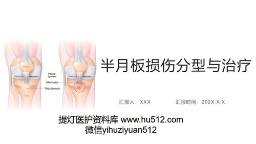 a0043 半月板损伤分型与治疗