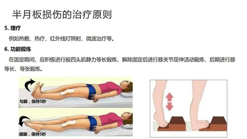 a0043 半月板损伤分型与治疗 第10页