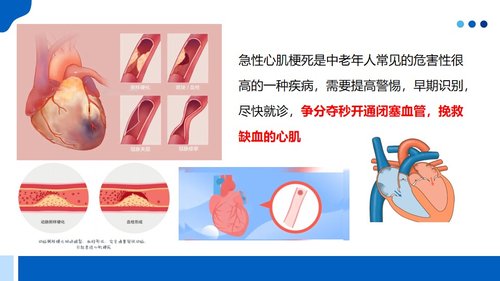 a0046 心肌梗死的宣教 第2页