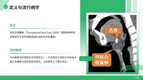 a0047 甲状舌管囊肿（TGDC）护理查房 第3页