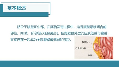 a0048 脐疝的护理查房 第3页