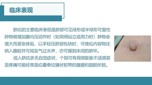 a0048 脐疝的护理查房 第4页