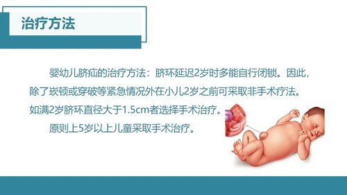a0048 脐疝的护理查房 第6页