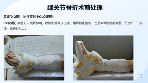 a0050 踝关节骨折围手术期护理 第6页