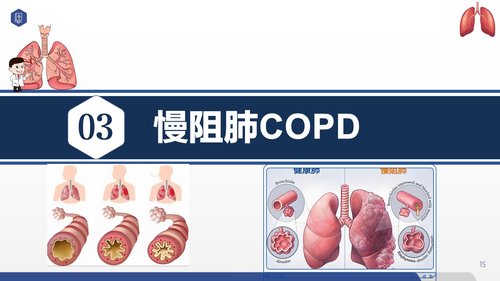 a0056 常见呼吸系统疾病护理PPT课件33页可编辑无水印 第5页