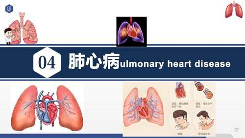 a0056 常见呼吸系统疾病护理PPT课件33页可编辑无水印 第7页
