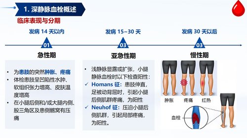 a0058 深静脉血栓预防与护理PPT课件33页可编辑无水印 第4页