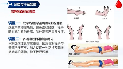 a0058 深静脉血栓预防与护理PPT课件33页可编辑无水印 第14页