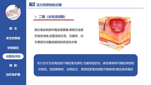 a0060 压力性损伤的预防及护理PPT课件21页可编辑无水印 第5页
