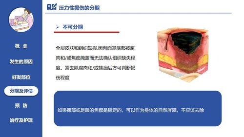 a0060 压力性损伤的预防及护理PPT课件21页可编辑无水印 第8页