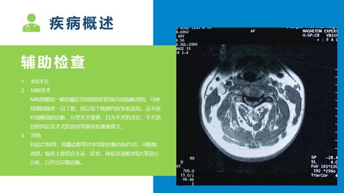 a0103 脊髓型颈椎病患者的个案护理查房PPT课件19页可编辑无水印 第6页