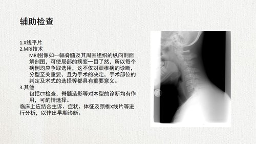 a0104 脊髓型颈椎病患者的个案护理查房02PPT课件22页可编辑无水印 第6页