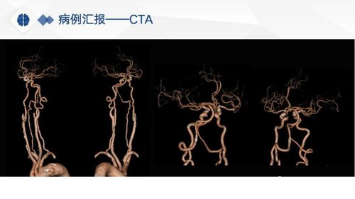 幻灯片9