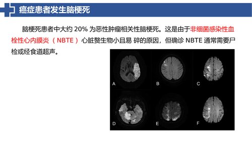 幻灯片15