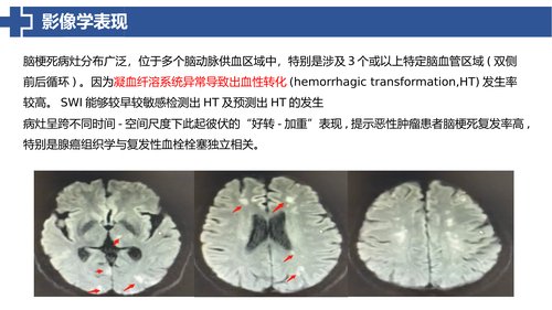 幻灯片16
