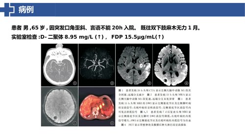 幻灯片17