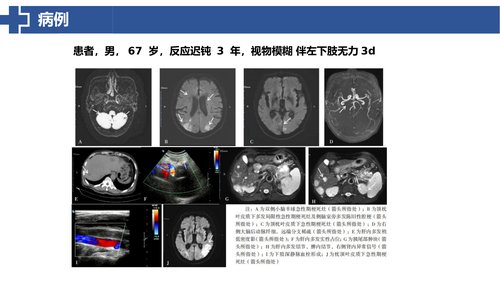 幻灯片18