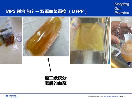 幻灯片15