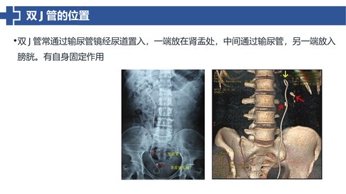 幻灯片12