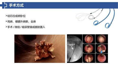 幻灯片13