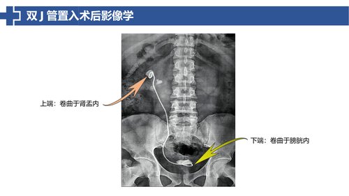 幻灯片14