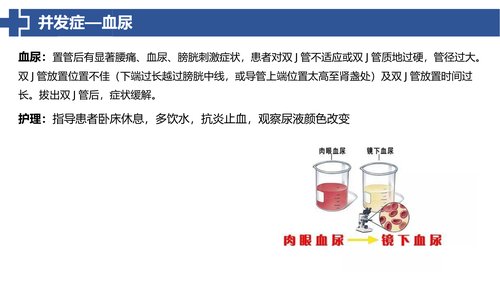 幻灯片20