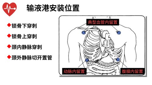幻灯片11