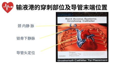 幻灯片12
