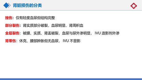 幻灯片14