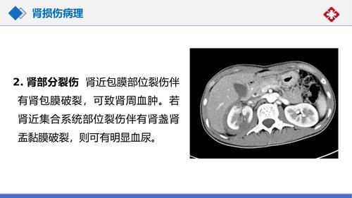 幻灯片17