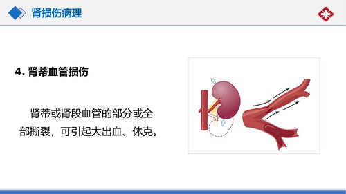 幻灯片19