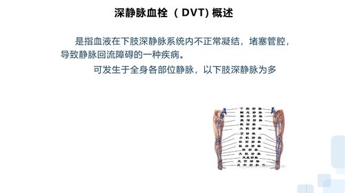 幻灯片6