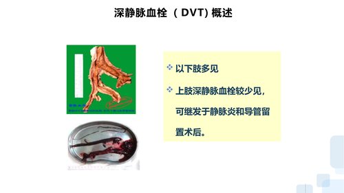 幻灯片8