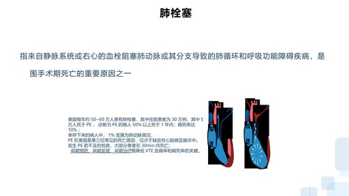 幻灯片10