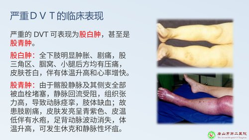 幻灯片11