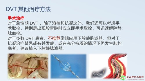 幻灯片17