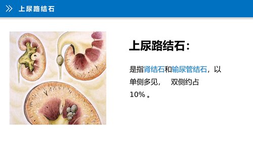 幻灯片10