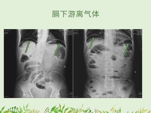幻灯片15