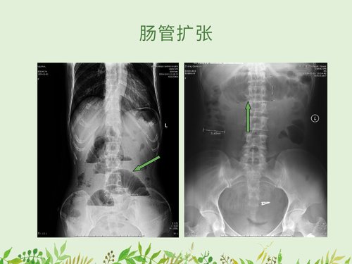 幻灯片16