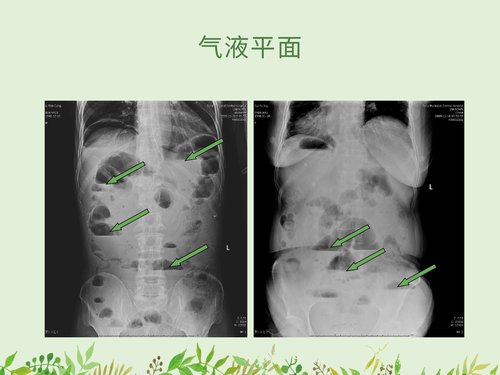 幻灯片17