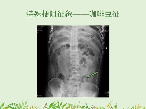 幻灯片18