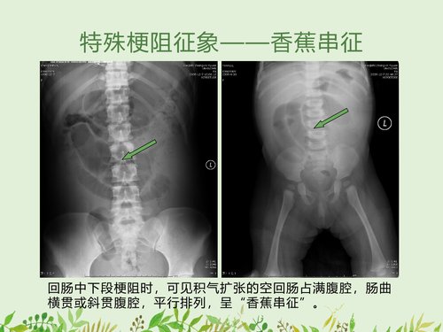 幻灯片19